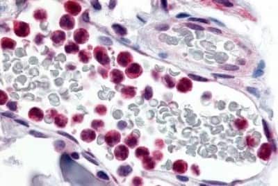 Immunohistochemistry-Paraffin: EMR3 Antibody [NBP3-14559] - Immunohistochemistry of formalin-fixed, paraffin-embedded human tissue staining neutrophils after heat-induced antigen retrieval.
